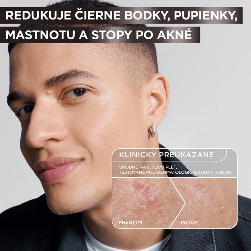 Pure Active Charcoal sérum - 5